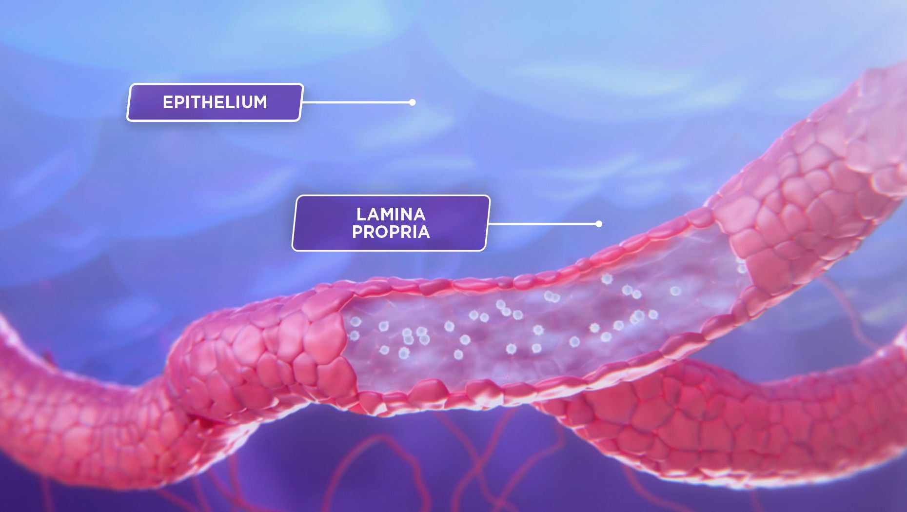 Memory T-lymphocytes blocked from entering the lamina propria and epithelium of the GI tract.